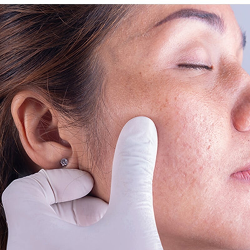General Principles of Dermatology General Principles of Dermatology