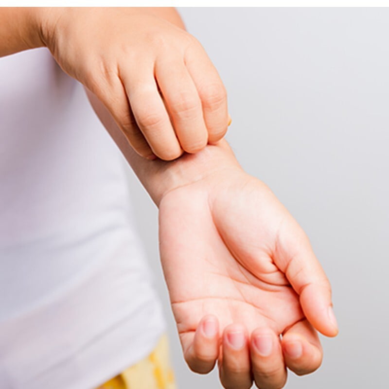 Infections, Infestations and Bites Infections, Infestations and Bites